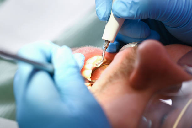 Best Weekend Emergency Dentist in Mount Pleasant, TN